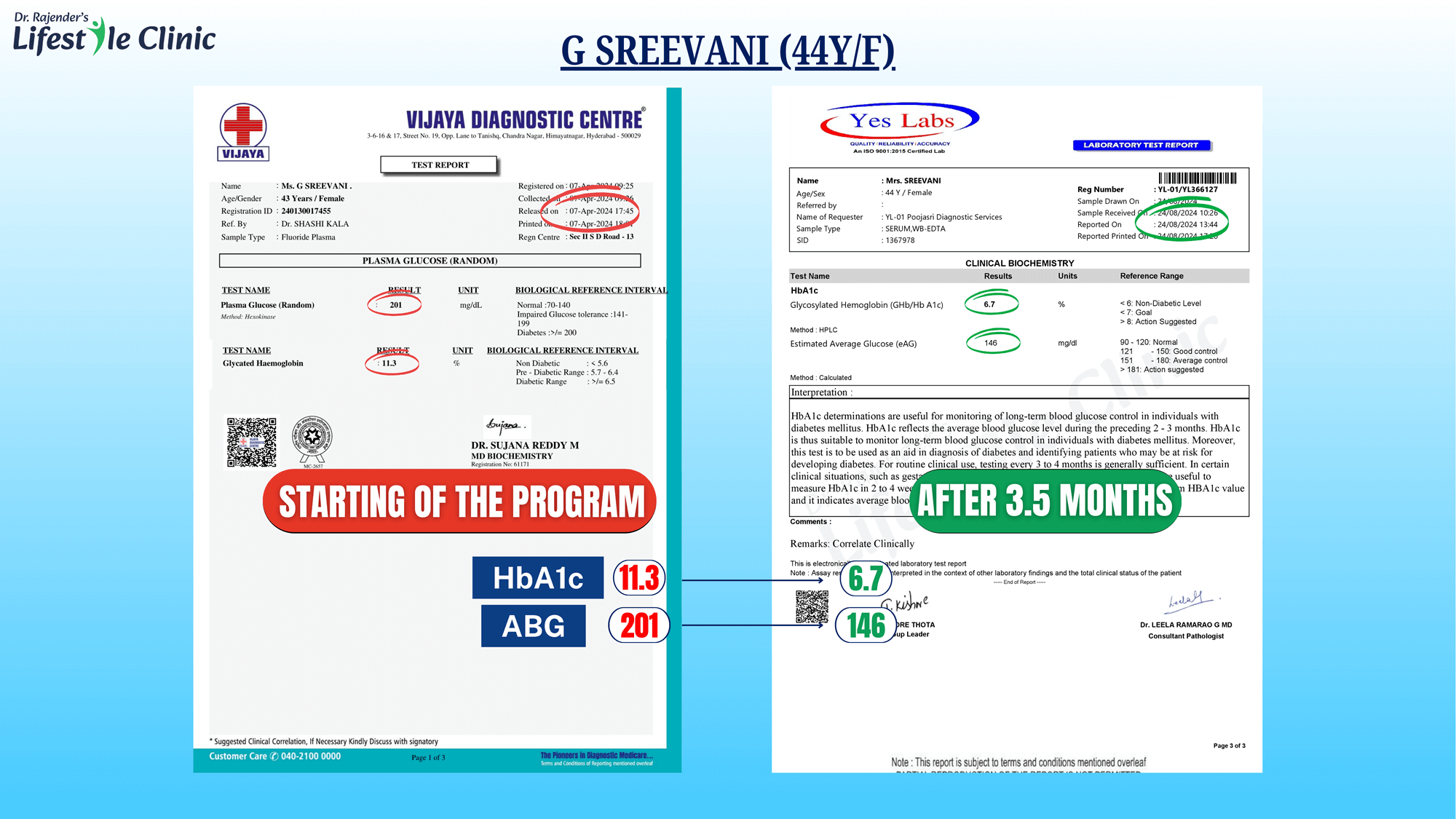 GSREEVANI44YF_u2otc_2000