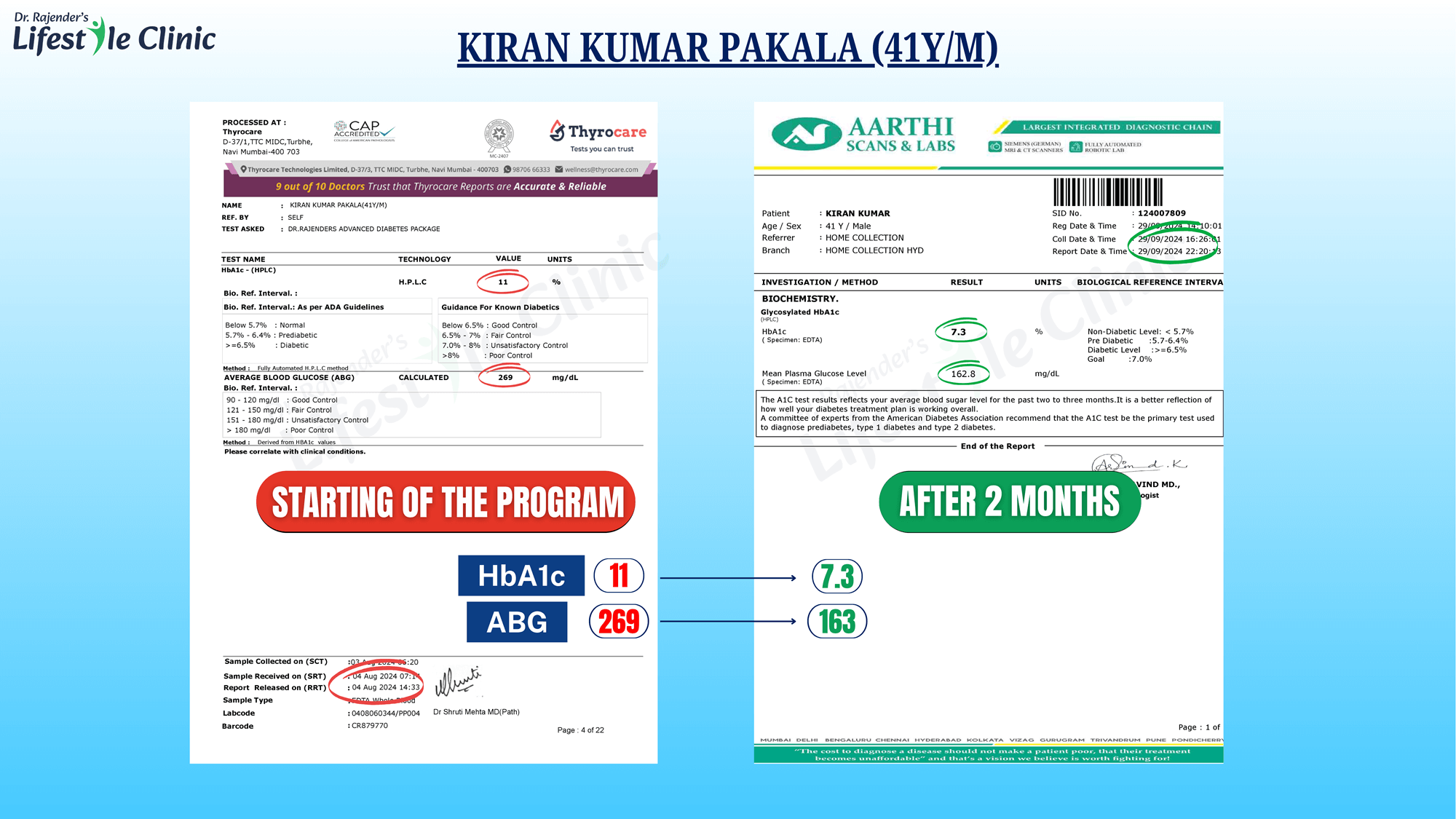 KIRANKUMARPAKALA41YM1_c3otc_2000
